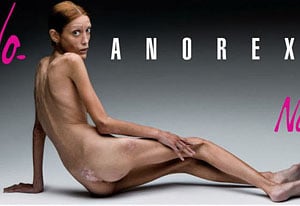 Anoreksja u móedzieży